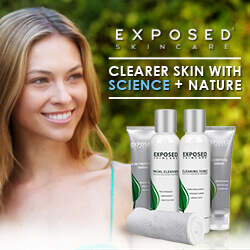 Exposed Skincare Affiliate Marketing, ShareASale